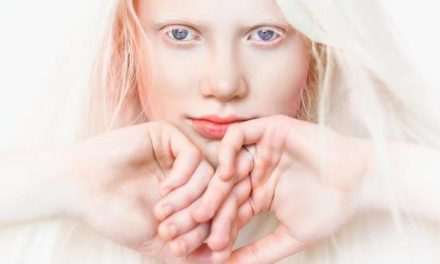 El Día D / Erradicar la discriminación contra las personas albinas